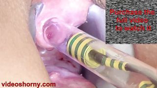 Woman Pee Hole Playing, Urethral Insertion with Endoscope Cam