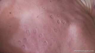 Trampling Really Hurts