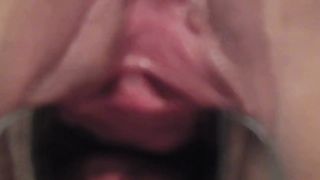 Speculum und peehole