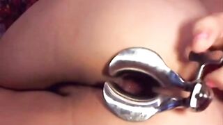 Webcam girl dildo and speculum in asshole by M.D.F 2