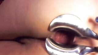 Webcam girl dildo and speculum in asshole by M.D.F 2